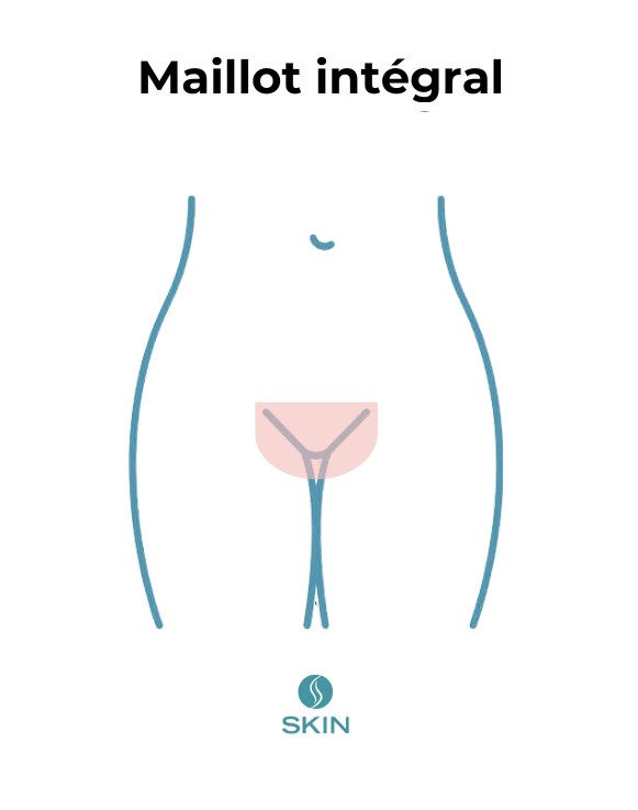 épilation laser maillot intégral