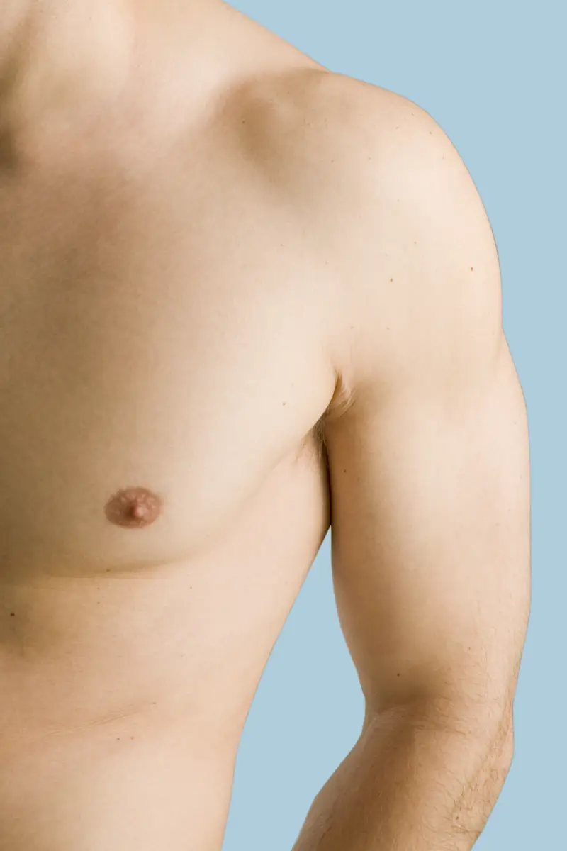 épilation laser hommes paris